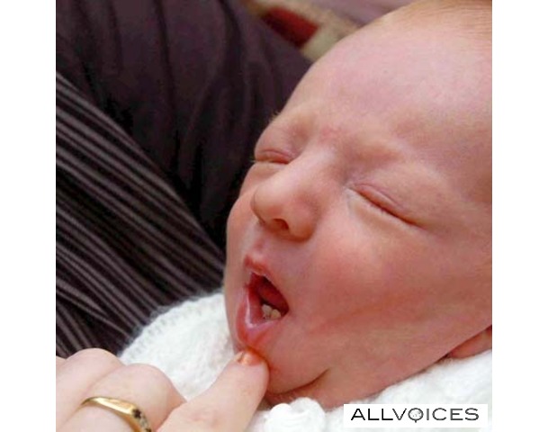 Νεογέννητο μωρό με… δόντια!